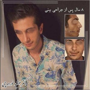 بهترین جراح بینی اصفهان 3