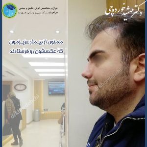 جراحی بینی اصفهان 63