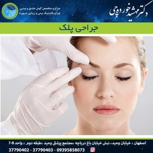جراحی پلک در اصفهان - دکتر مهشید خورده چی