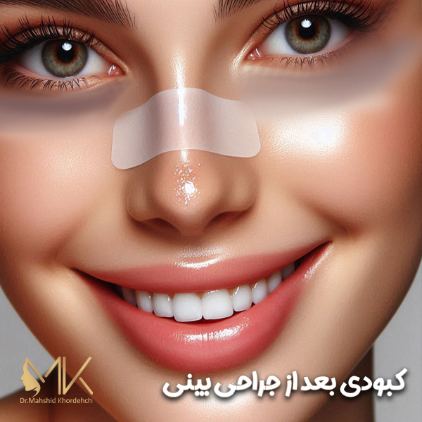 کبودی بعد از جراحی بینی - دکتر مهشید خورده چی