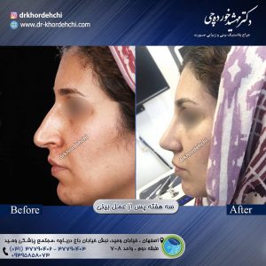 جراح بینی اصفهان - دکتر مهشید خورده چی
