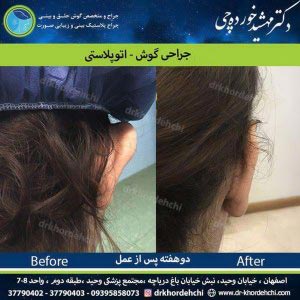 جراحی گوش در اصفهان - دکتر مهشید خورده چی