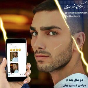 جراحی بینی در اصفهان - دکتر مهشید خورده چی 