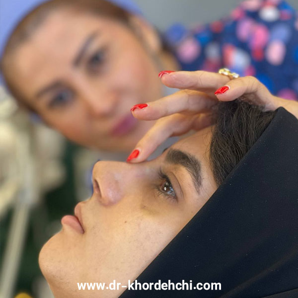 جراحی بینی طبیعی در اصفهان + دکتر مهشید خورده چی