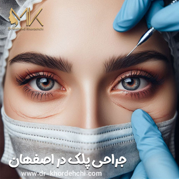 جراحی پلک در اصفهان - دکتر مهشید خورده چی