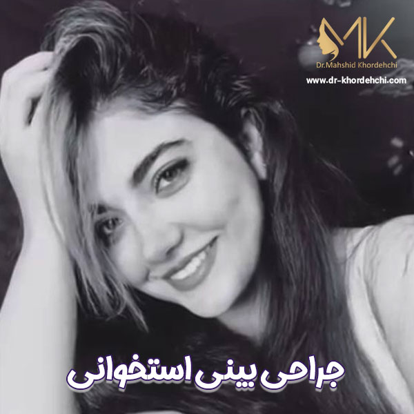 جراحی بینی استخوانی در اصفهان - دکتر مهشید خورده چی