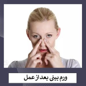 ورم بعد از عمل بینی _ دکتر مهشید خورده چی