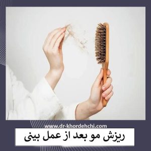 ریزش مو بعد از رینوپلاستی _ دکتر مهشید خورده چی