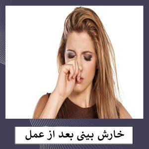 خارش بینی بعد از عمل _ دکتر مهشید خورده چی