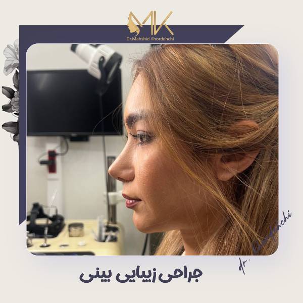 عکس عمل بینی در اصفهان