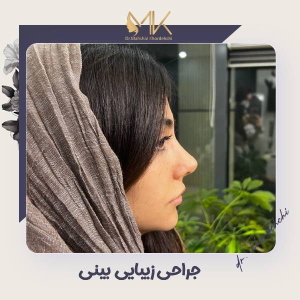 عکس عمل زیبایی بینی