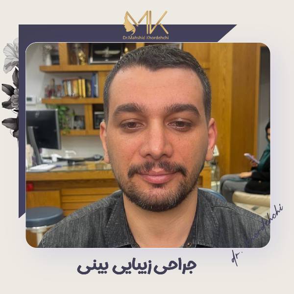 عکس جراحی زیبایی بینی