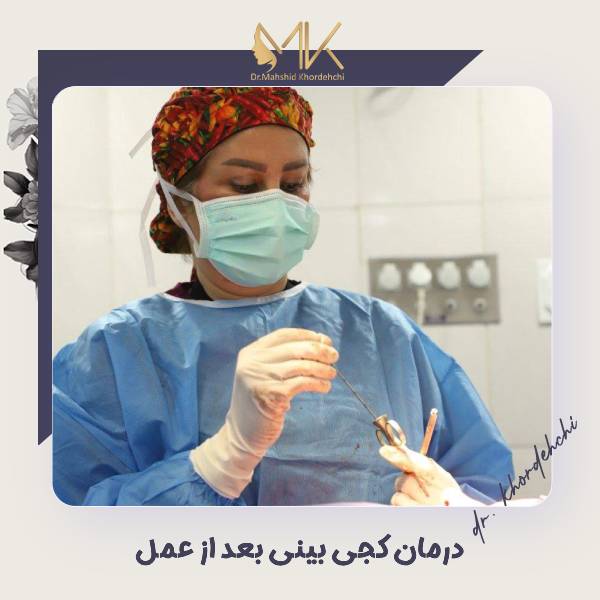 درمان کجی بینی بعد از جراحی