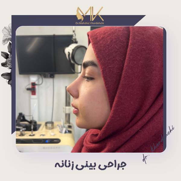 جراحی بینی زنانه