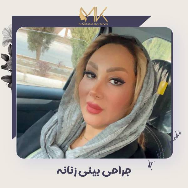 جراحی بینی زنان