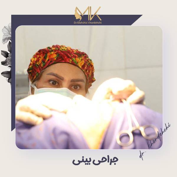 عکس نمونه جراحی بینی در اصفهان