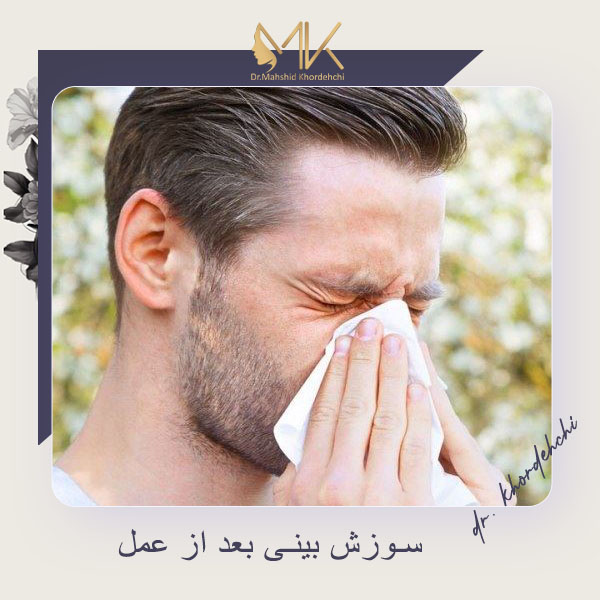 سوزش بینی بعد از عمل