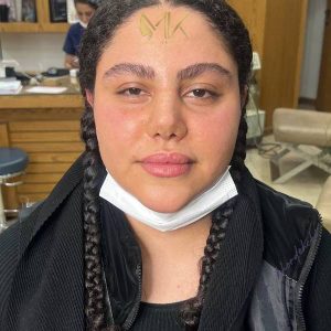 جراحی زیبایی بینی دکتر خورده چی