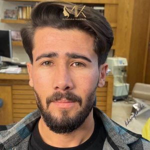 جراحی زیبایی بینی دکتر خورده چی