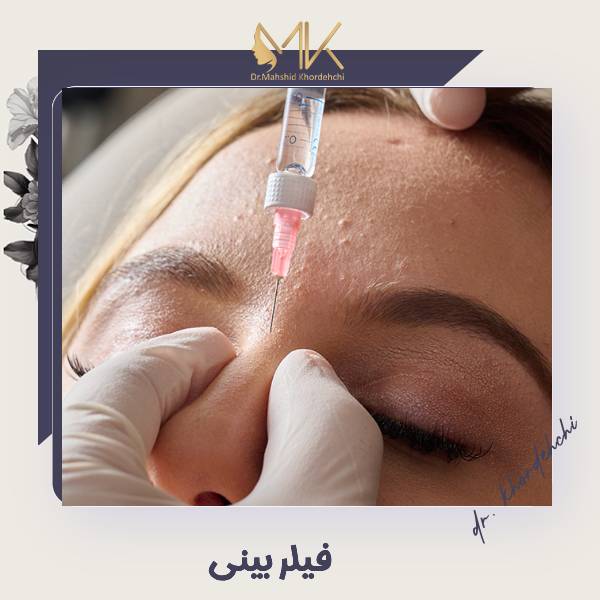 تزریق فیلر بینی