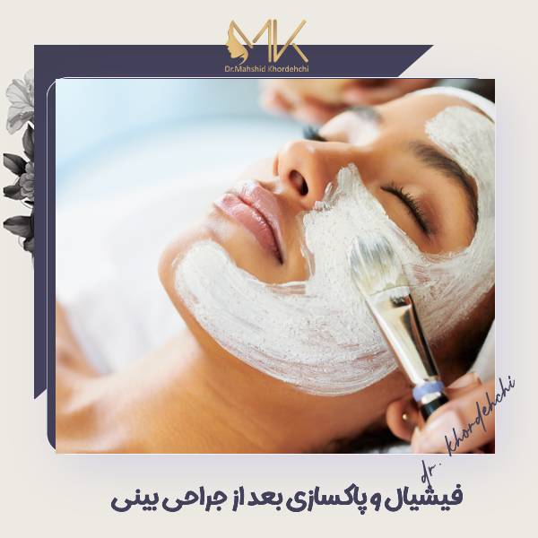 فیشیال بعد از جراحی بینی
