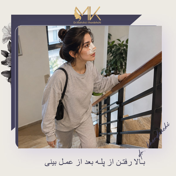 بالا رفتن از پله بعد از عمل بینی - دکتر خورده چی